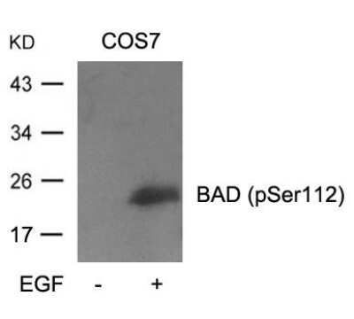 Western Blot: Bad [p Ser112] Antibody [NB100-81807]